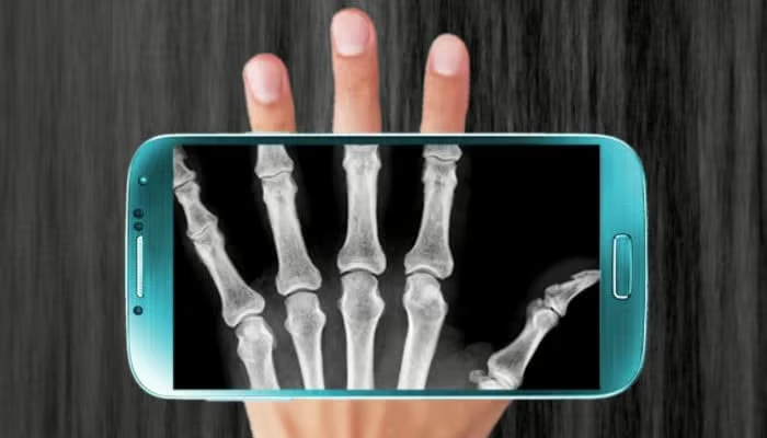 Meilleures applications de radiographie pour téléphones portables