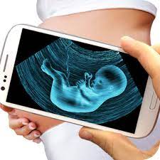 Applications to perform Ultrasound on your cell phone